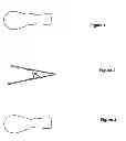 Fig. 02 - 