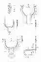 Fig. 07 - Valve lifter assembly for internal combustion engine