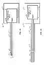 Fig. 02 - Occlusive implant delivery devices and associated methods