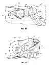 Fig. 09 - Occlusive implant delivery devices and associated methods