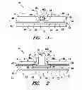 Fig. 02 - SUPPORT INSERT FOR THIN FILM PHOTOVOLTAIC DEVICES AND THEIR METHODS OF MANUFACTURE