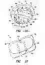 Fig. 09 - SUPPORT INSERT FOR THIN FILM PHOTOVOLTAIC DEVICES AND THEIR METHODS OF MANUFACTURE
