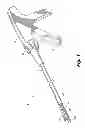Fig. 02 - Buttress attachment to the cartridge surface