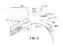 Fig. 07 - Guiding pathway