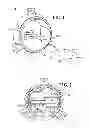 Fig. 02 - Foreign body detecting