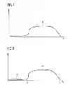 Fig. 04 - Magnetic resonance system and method to generate a magnetic resonance image of an examination subject