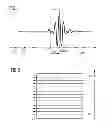 Fig. 02 - Method and device to generate magnetic resonance image data of an examination subject