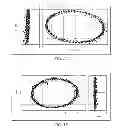 Fig. 06 - Control of magnetically actuated tools in any position using a rotating magnetic source