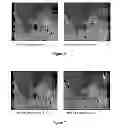 Fig. 07 - Refinement of depth maps by fusion of multiple estimates