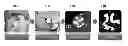 Fig. 01 - Method and system for aortic valve calcification evaluation