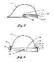 Fig. 05 - Portable light source