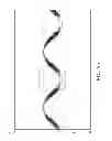 Fig. 09 - Amplifying circuit capable of suppressing spikes of an audio signal