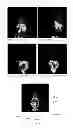 Fig. 09 - METHOD OF PREPARING ETHACRYNIC AMIDE DERIVATIVES AND APPLICATION THEREOF