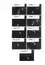 Fig. 02 - Bone Augmentation Utilizing Muscle-Derived Progenitor Compositions, And Treatments Thereof