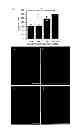 Fig. 02 - Methods of recellularizing a tissue or organ for improved transplantability