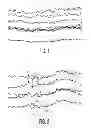 Fig. 02 - TREATMENT OF DISEASES