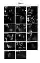 Fig. 07 - Compositions and methods for treating cancer and modulating stress granule formation