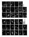 Fig. 08 - Compositions and methods for treating cancer and modulating stress granule formation