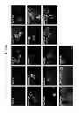 Fig. 09 - Compositions and methods for treating cancer and modulating stress granule formation