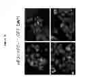 Fig. 22 - Compositions and methods for treating cancer and modulating stress granule formation