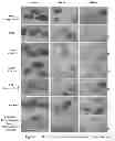 Fig. 02 - METHODS OF PREPARING CHORION TISSUE AND PRODUCTS DERIVED THEREFROM