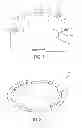 Fig. 02 - Adjustable nozzle for plasma deposition and a method of controlling the adjustable nozzle