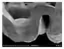 Fig. 01 - SUBSTRATES COMPRISING FROTHED BENEFIT AGENTS FOR ENHANCED SUBSTRATE BENEFITS