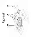Fig. 28 - Magnetically coupled system for mixing