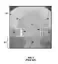 Fig. 02 - Methods for the fabrication of integrated circuits including back-etching of raised conductive structures