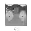 Fig. 06 - Methods for the fabrication of integrated circuits including back-etching of raised conductive structures