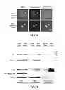 Fig. 02 - Method for treating and/or preventing neurodegenerative disease by adiponectin receptor agonist