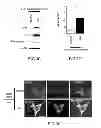 Fig. 06 - Method for treating and/or preventing neurodegenerative disease by adiponectin receptor agonist