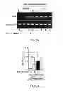 Fig. 09 - Method for treating and/or preventing neurodegenerative disease by adiponectin receptor agonist