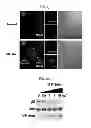 Fig. 07 - USE OF HADES AS TUMOR SUPPRESSOR TARGET