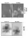 Fig. 41 - TG2 inhibitors and uses thereof