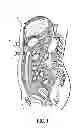 Fig. 02 - Apparatus and system for performing surgery
