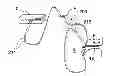 Fig. 01 - Methods for thermally-induced renal neuromodulation