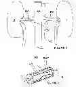 Fig. 02 - Methods for thermally-induced renal neuromodulation