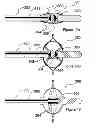 Fig. 08 - Methods for thermally-induced renal neuromodulation