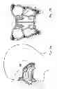 Fig. 02 - Stimulation of hypothalamus