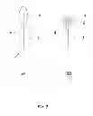 Fig. 03 - Stimulation of hypothalamus