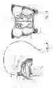 Fig. 05 - Stimulation of hypothalamus