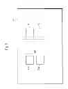 Fig. 06 - Hemodialysis system