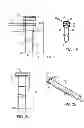 Fig. 02 - Systems and method for bypassing an anastomosis site