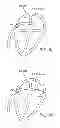 Fig. 06 - Apparatus and method for sensing force on a robotically controlled medical instrument