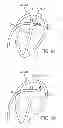 Fig. 07 - Apparatus and method for sensing force on a robotically controlled medical instrument