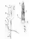 Fig. 02 - Indwelling heat exchange catheter and method of using same