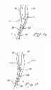 Fig. 09 - Indwelling heat exchange catheter and method of using same