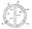 Fig. 01 - LUMINAL MODIFICATIONS FOR CATHETERS