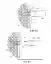 Fig. 09 - Apparatus and method for forming pilot holes in bone and delivering fasteners therein for retaining an implant